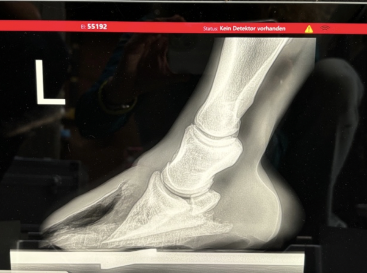 Mi Vida White Line Disease